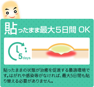 貼ったまま最大5日間OK!