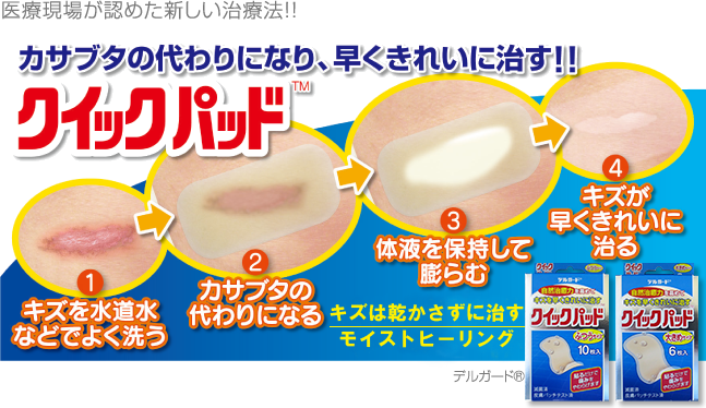 クイックパッド
