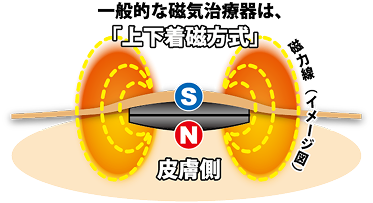 一般的な磁気治療器は、「上下着磁方式」 磁力線（イメージ図）