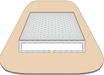 ネット巻込み式パッドの構造