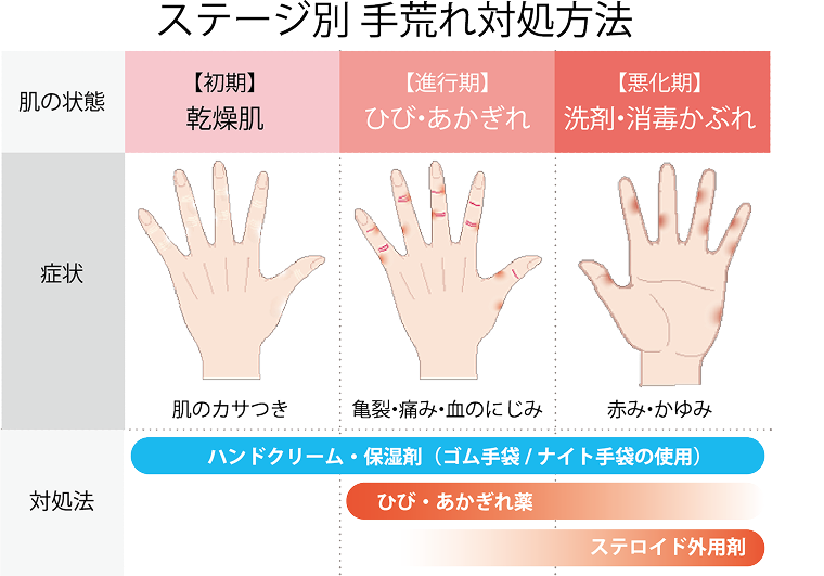 ステージ別手荒れ対処法の図