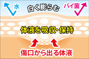 傷口から出る体液を吸収・保持することで自然治癒力を高める治療法です。