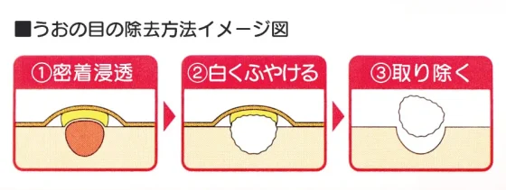 CB_Howto_01