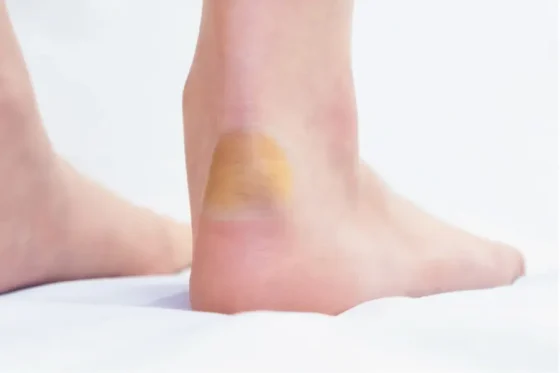 QPad_Footcare06_H01