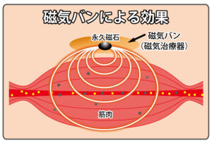磁気バン説明図03　磁気バンによる効果