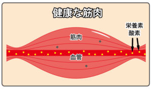磁気バン説明図01　健康な筋肉